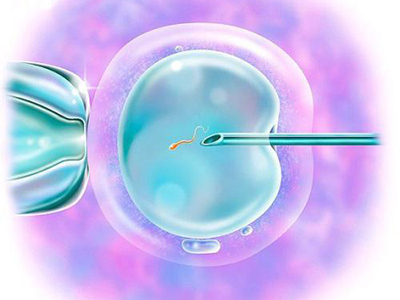 输卵管通而不畅该做手术还是选择试管婴儿辅助生殖？
