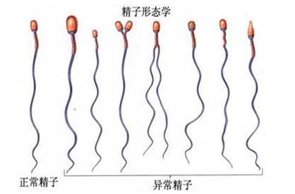 喜孕多小课堂——精子畸形率高能做人工授精吗？