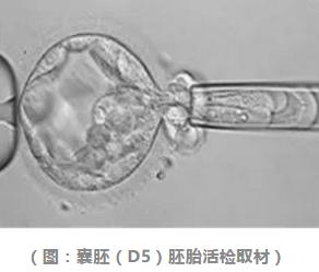 喜孕多小课堂：每个胚胎都应该筛查吗？