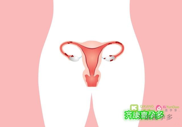 雌激素偏低怎么办？女性“雌激素”偏低该如何补充？