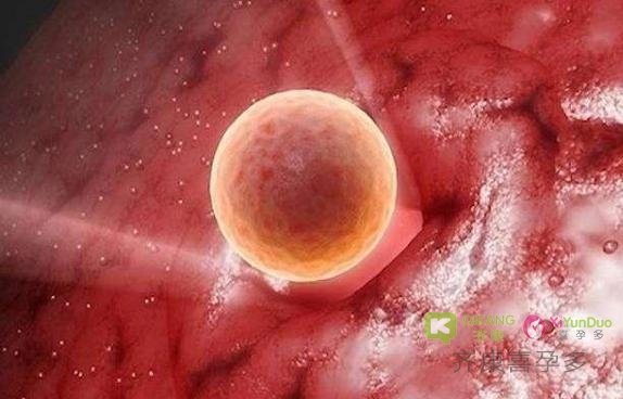 反复胚胎种植失败怎么破？IVF周期治疗性子宫内膜搔刮有帮助