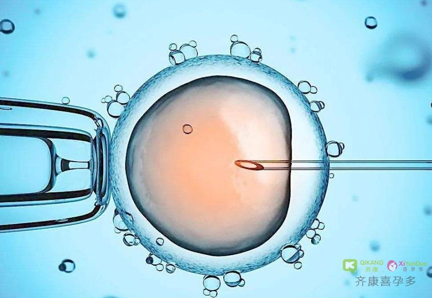 非男性因素不孕和非整倍体胚胎植入前基因检测的夫妇，卵胞浆内精子注射并不优于常规IVF