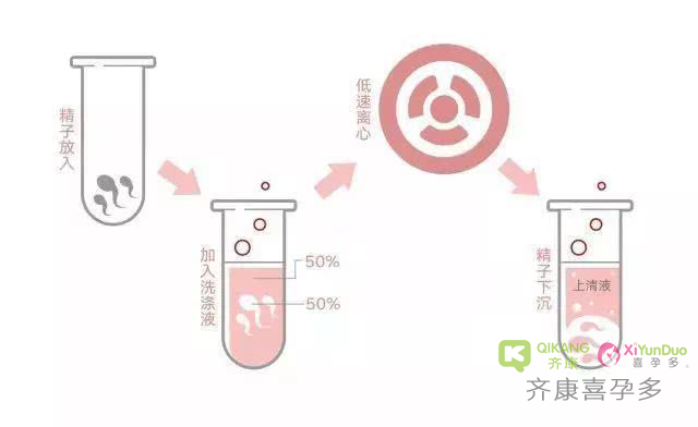 齐康喜孕多告诉你：贫血备孕需要知道哪些