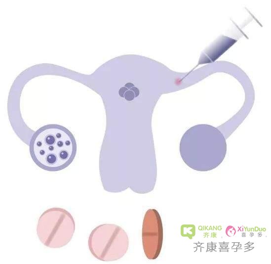 有子宫内膜息肉做试管需要先手术拿掉吗？