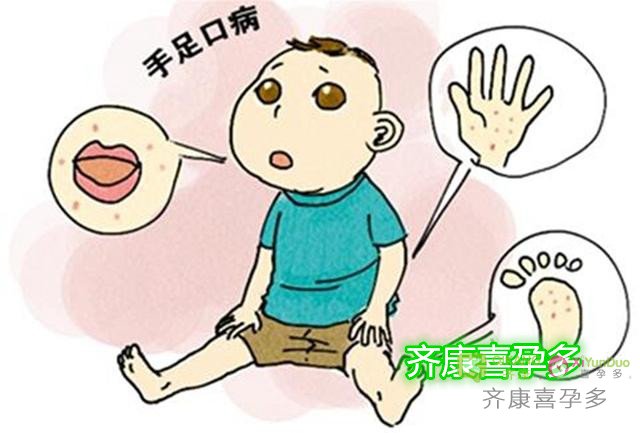 喜孕多告诉你：春季容易诱发哪些疾病