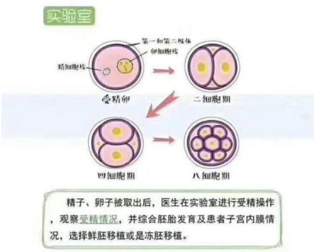 泰国三代试管婴儿取卵过程痛不痛？