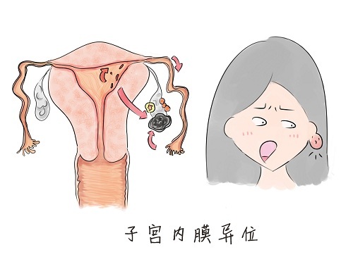 做试管婴儿，哪四类女性最容易一次性成功？