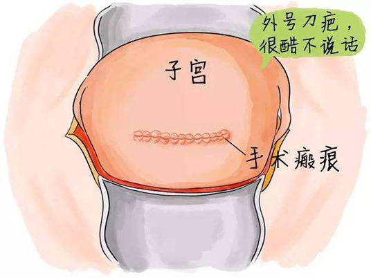 盘点试管婴儿过程中子宫最害怕出现的情况