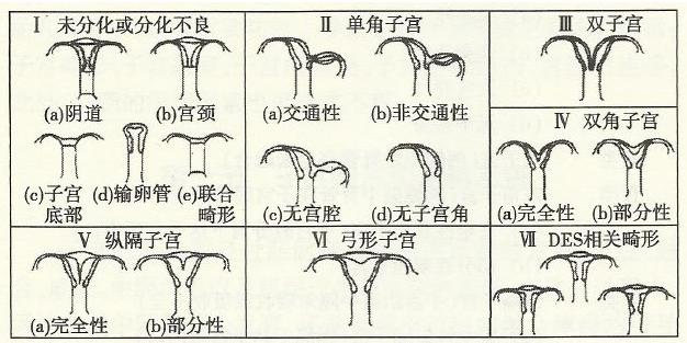 什么是先天性不孕不育？