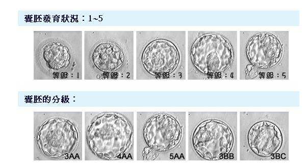 试管婴儿囊胚分级 3BB和3AB、3AA都是什么意思？有什么区别？