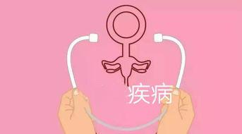 哪几种疾病是女性容易高发的疾病？