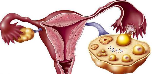 年轻女性中卵巢储备正常与降低者宫腔内授精后妊娠结局的比较