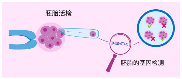 因为不孕不育做试管出生的宝宝，会不会遗传不孕不育？