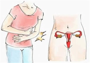 子宫不好的女性，身体会发出哪些信号？