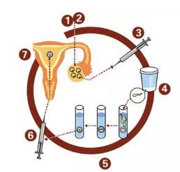 高龄女性做试管针对子宫环境不好可以试下这个办法