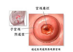 齐康喜孕多告诉你：女性白带增多，多半是这些原因