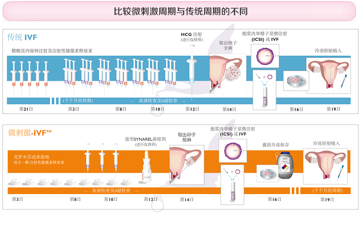 喜孕多小课堂——试管婴儿微刺激方案和流程