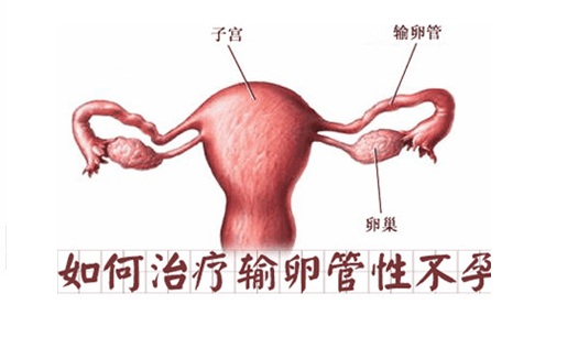 输卵管堵塞的治疗效果怎么样？是做手术还是做试管更好呢？