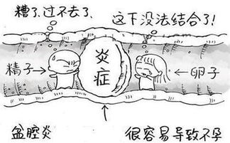 女人不孕，这几项检查得赶紧做