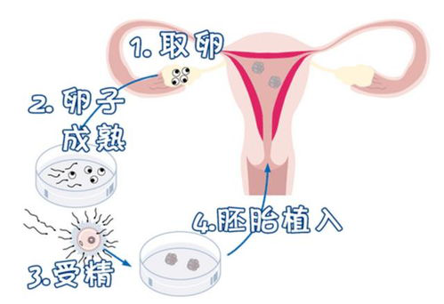 喜孕多告诉你：想试管一次成功，这6点才是你应该关注的!
