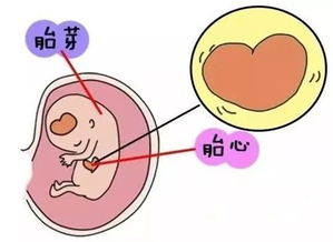 历尽千辛万苦怀上的，多久才能听见他的胎心呢？