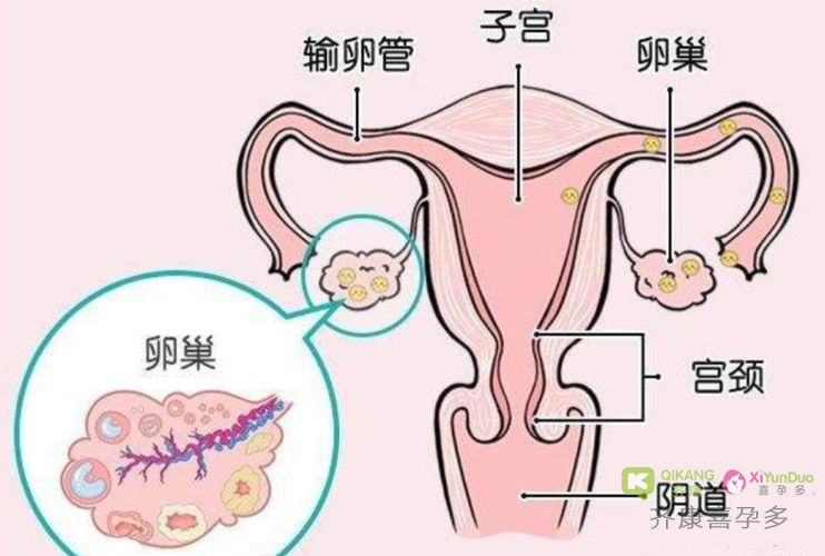 医生评判卵巢好不好，是看哪几项？