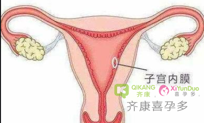 子宫内膜过厚又是如何造成的？