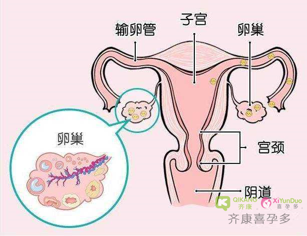 卵巢功能好不好？做那几项检查就能知道