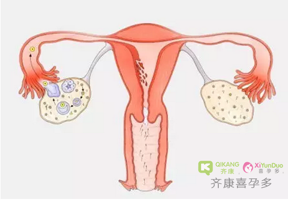 喜孕多告诉你：美容院的“卵巢保养”真的交智商税吗？