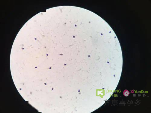 明明有精液，为什么没精子？