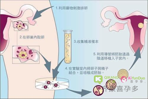 试管婴儿和自然受孕的一样的吗？