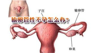 输卵管堵塞可以试管吗？