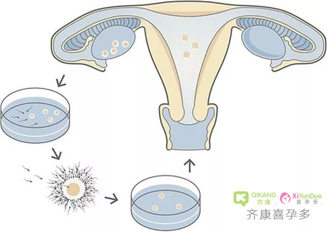 试管移植胚胎生化是原因？