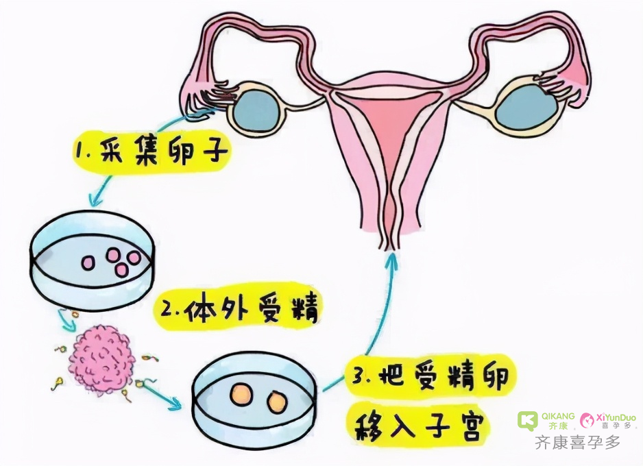 试管反复移植失败的原因有哪些？