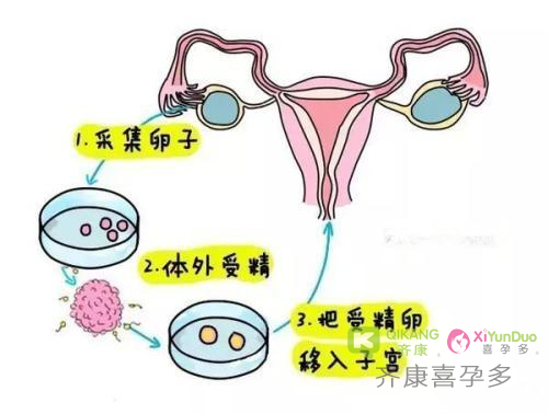 喜孕多告诉你：怎样提高试管成功率？