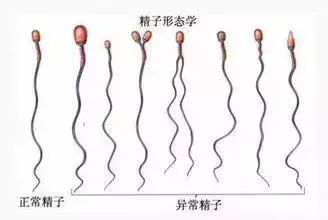 男性生育力断崖式下跌？则该如何改善呢？