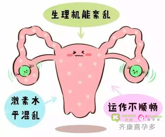 喜孕多告诉你：卵巢功能早衰的表现有哪些?