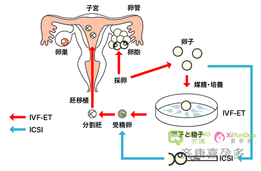 喜孕多告诉你：为什么说做试管要趁早