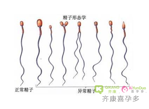 阳了以后，男性精子有影响吗？