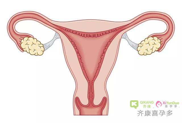 导致女性不孕不育的原因有哪些？