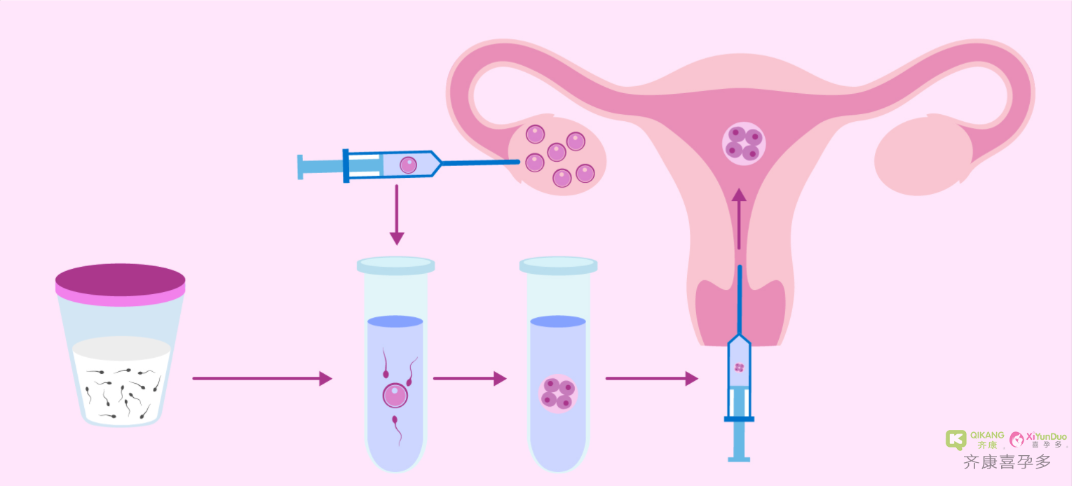 喜孕多告诉你：试管婴儿怎么选？
