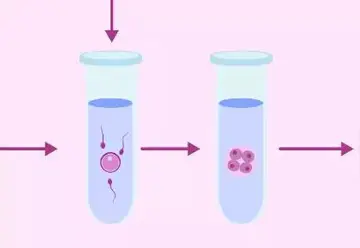 喜孕多告诉你：试管婴儿怎么选？