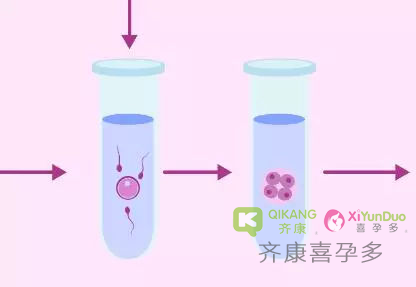 喜孕多告诉你：二代试管适应的人群