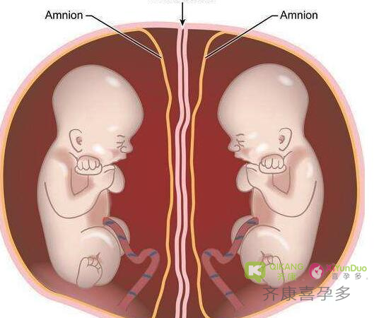 喜孕多告诉你：自然怀孕双胞胎是怎么形成的？