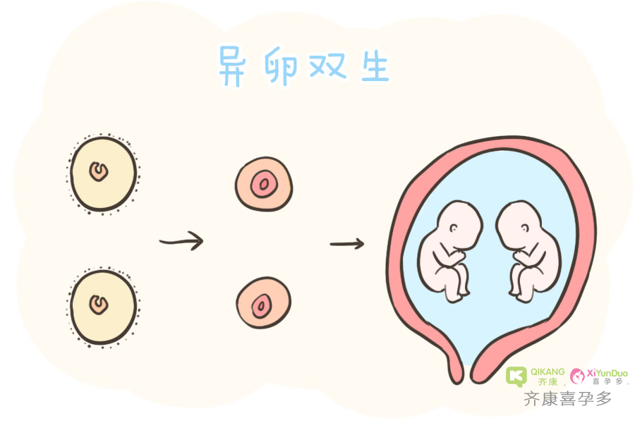 喜孕多告诉你：自然怀孕双胞胎是怎么形成的？
