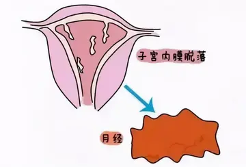 喜孕多告诉你：试管婴儿移植，内膜过厚该怎么办？