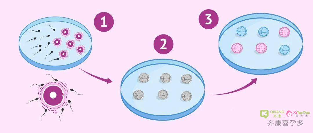 喜孕多告诉你：试管婴儿一代比一代好吗？