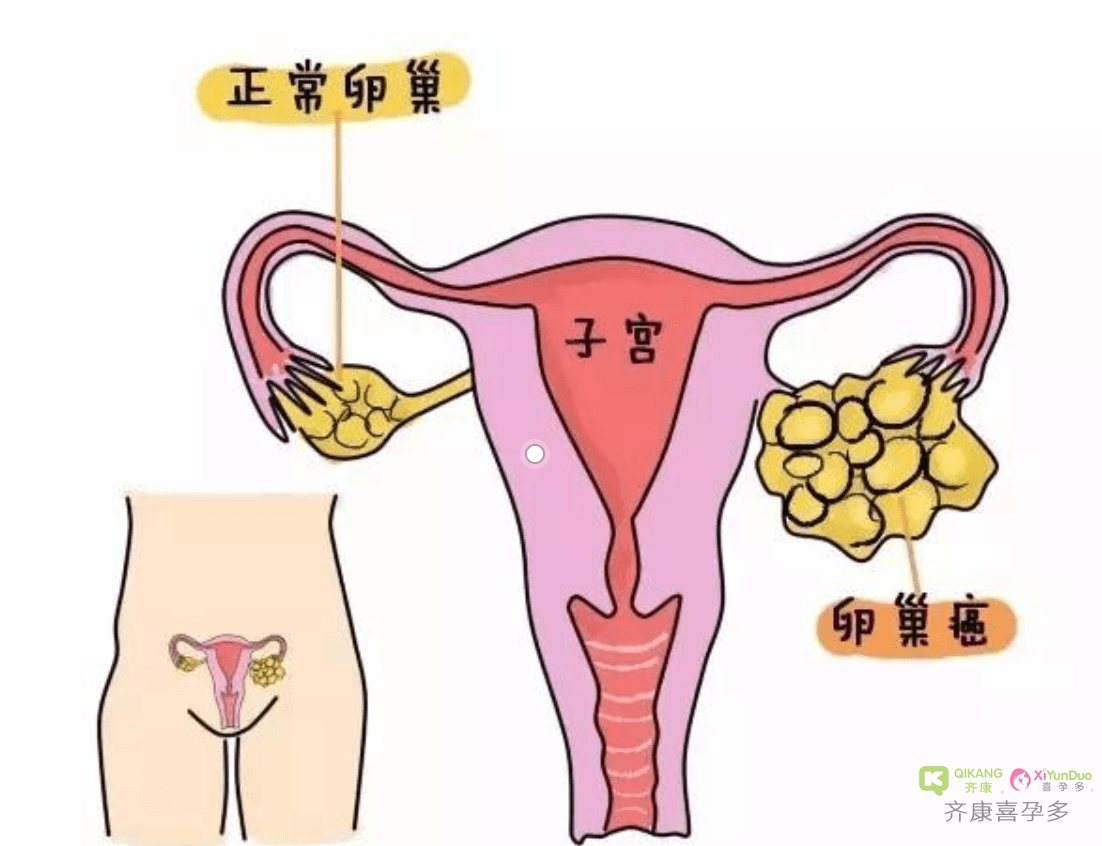卵巢有哪些功能？卵巢功能怎么样?怎样检查来判断?