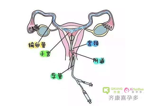 女性不孕不育和原发性不孕不育的定义是什么？