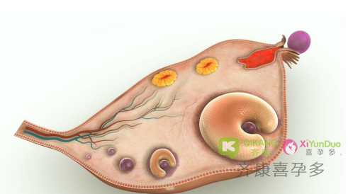 什么是卵巢早衰？卵巢早衰该怎么拯救？